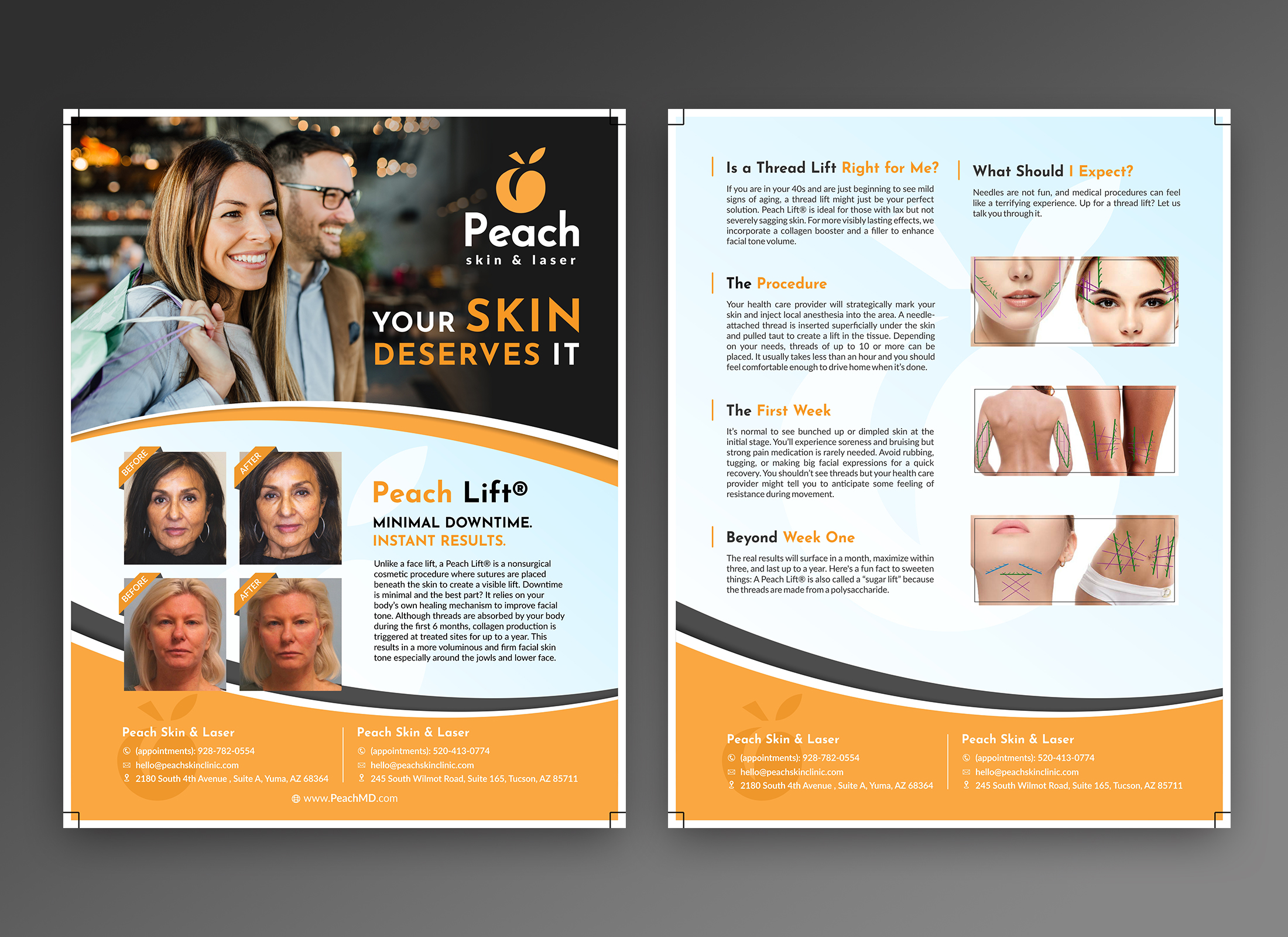 Flyer Design by OwnDesign for Peach Skin & Laser | Design #24355223