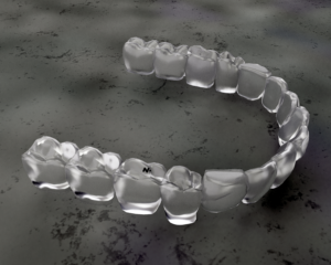 Diseño 3D por Your_Design para Magicalign | Diseño: #24693207