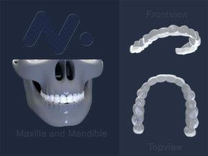 3D Design by rpgraphics888 for Magicalign | Design #24680027
