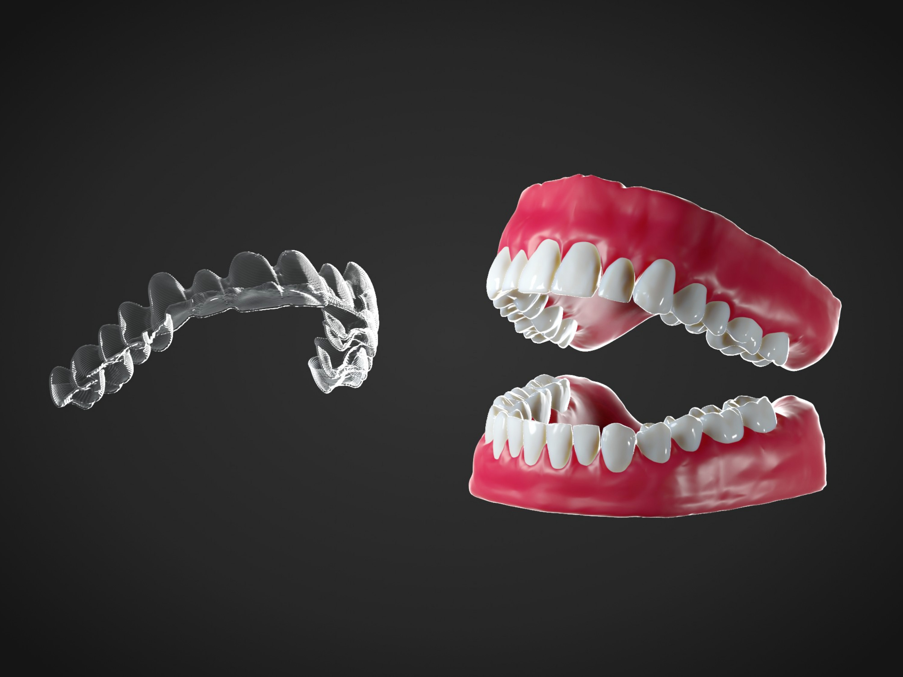 3D Design by Yacine Tutmicy for Magicalign | Design #24664939