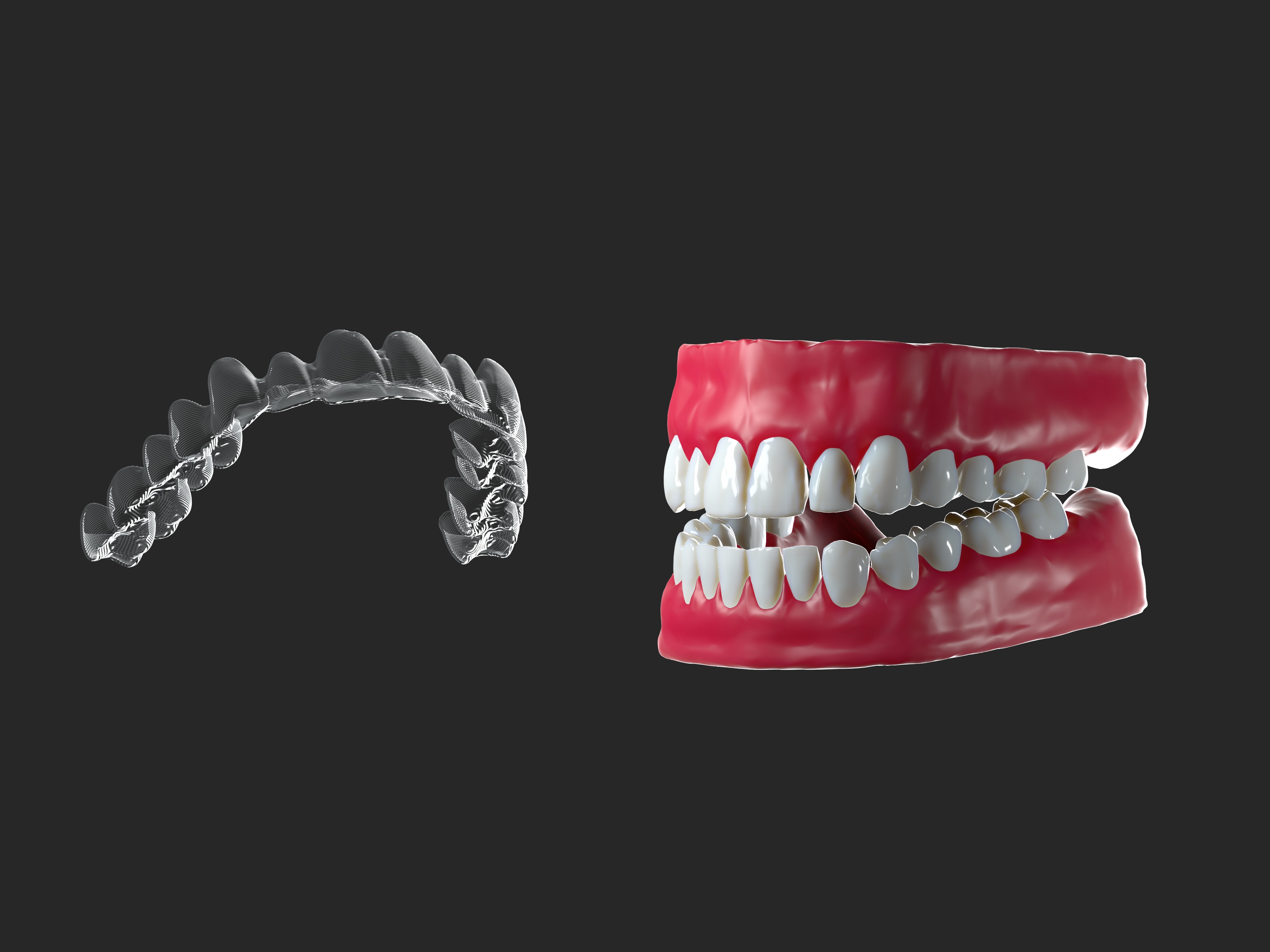 3D Design by Yacine Tutmicy for Magicalign | Design #24665117