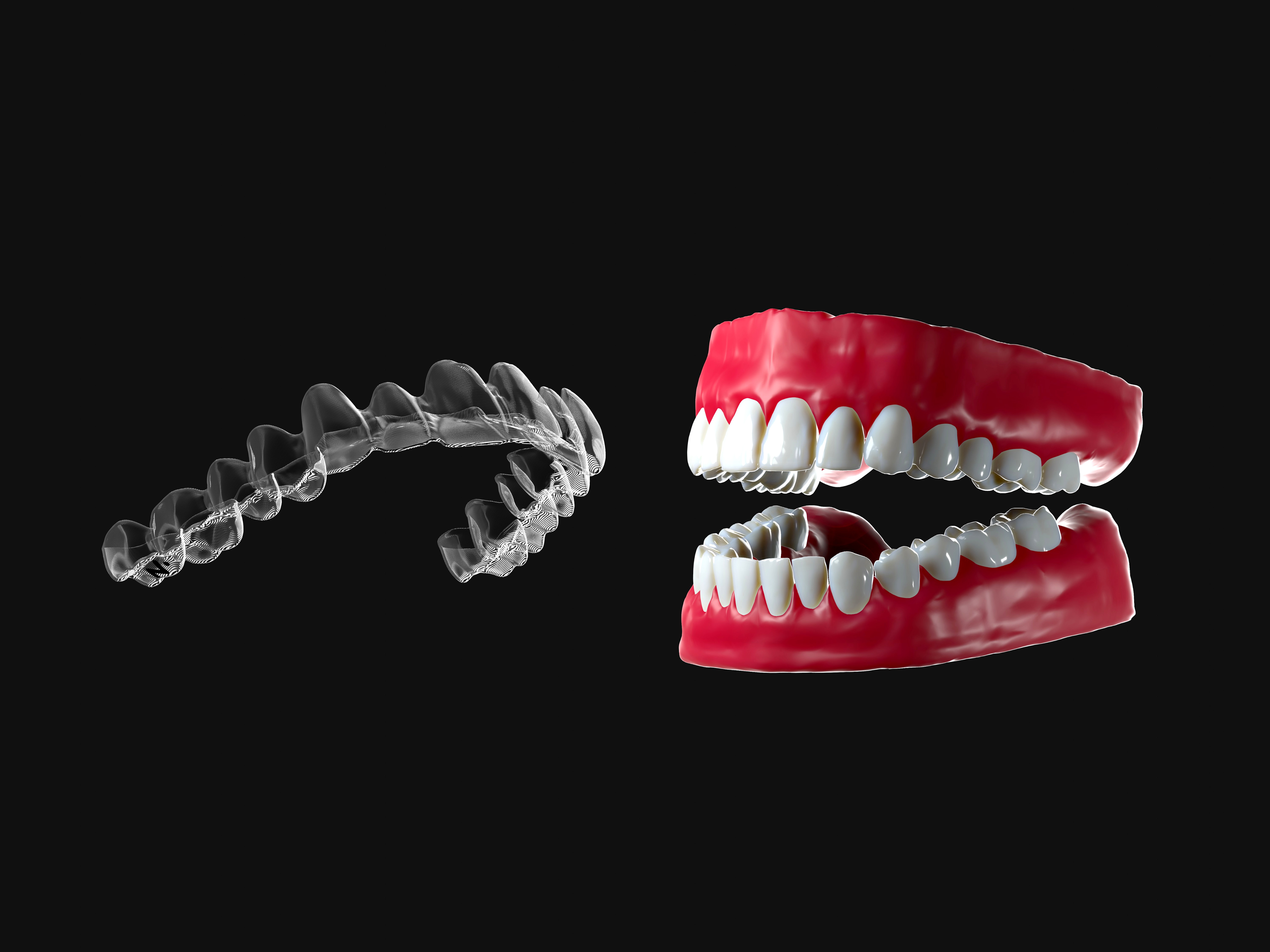3D Design by Yacine Tutmicy for Magicalign | Design #24699295