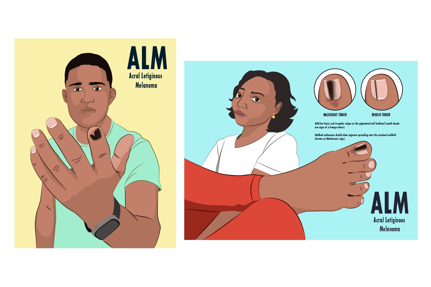 Illustration Design by YAS9 for University of utah | Design #25057058