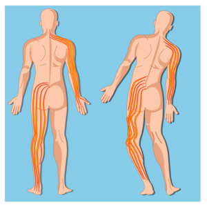Arm/Leg Pain and Loss of Balance Images | Grafik-Design von SAI DESIGNS