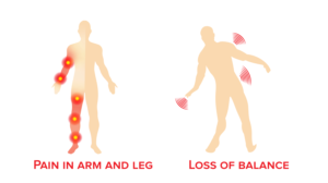 Arm/Leg Pain and Loss of Balance Images | Grafik-Design von Rickyy