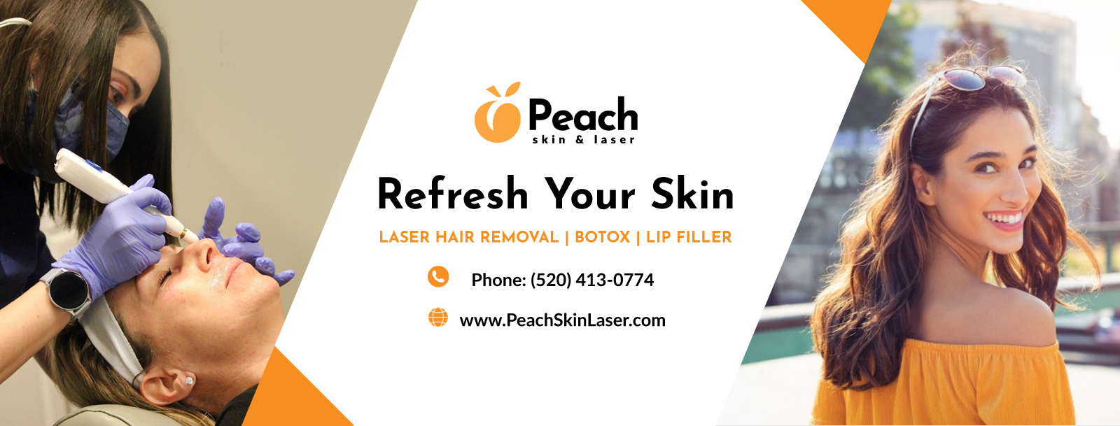 Diseño De Banner Publicitario por Blue Sparrow para Peach Skin & Laser | Diseño #26568165