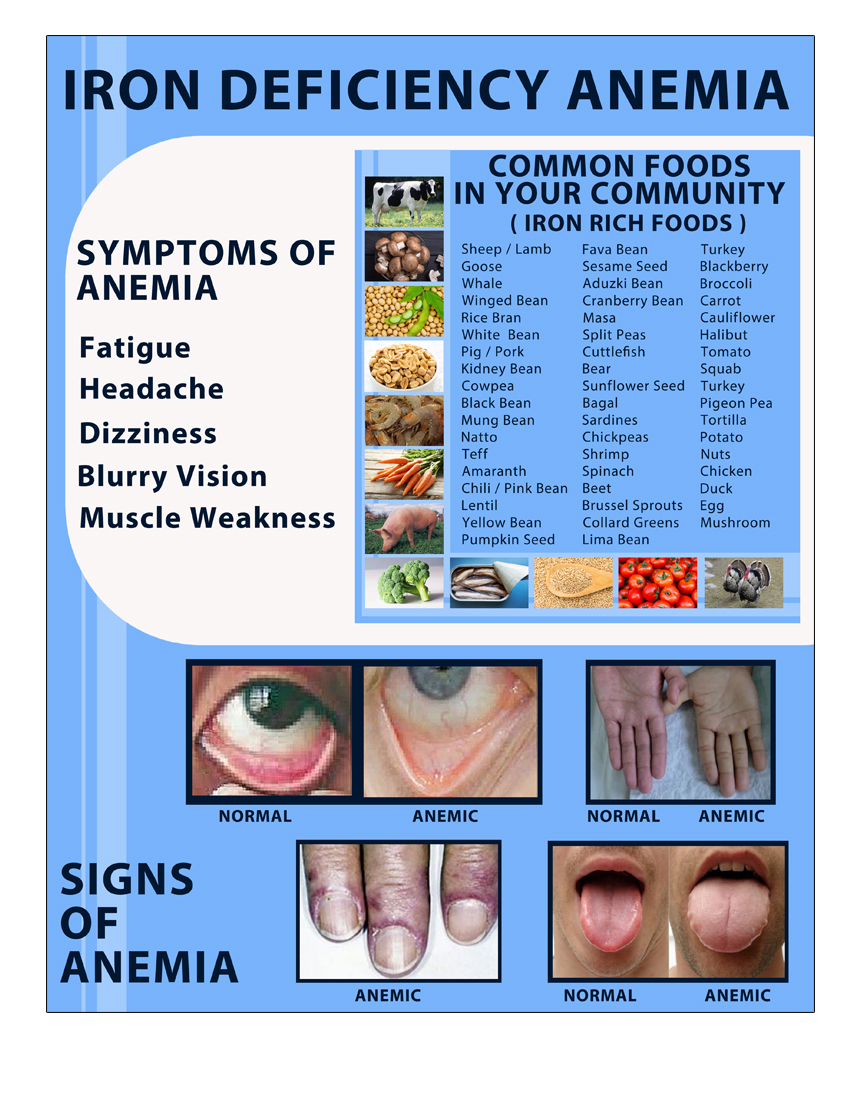 Poster Design by Rey Agustino for this project | Design #26975156