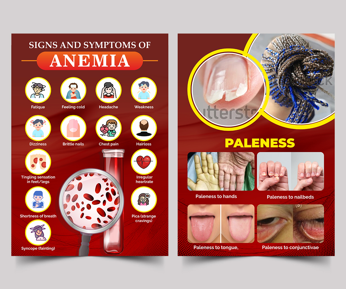 Flyer Design by ecorokerz for this project | Design #27021172
