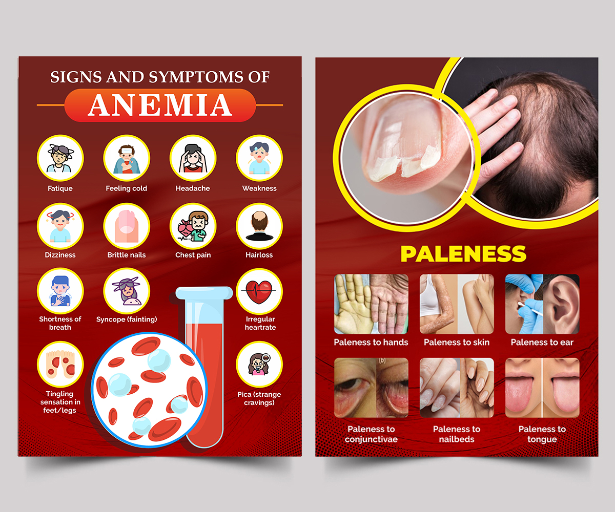 Flyer Design by ecorokerz for this project | Design #27025692