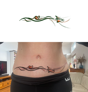 Tattoo to cover a scar that must be aviation related | Design de Tatouage par Mahder
