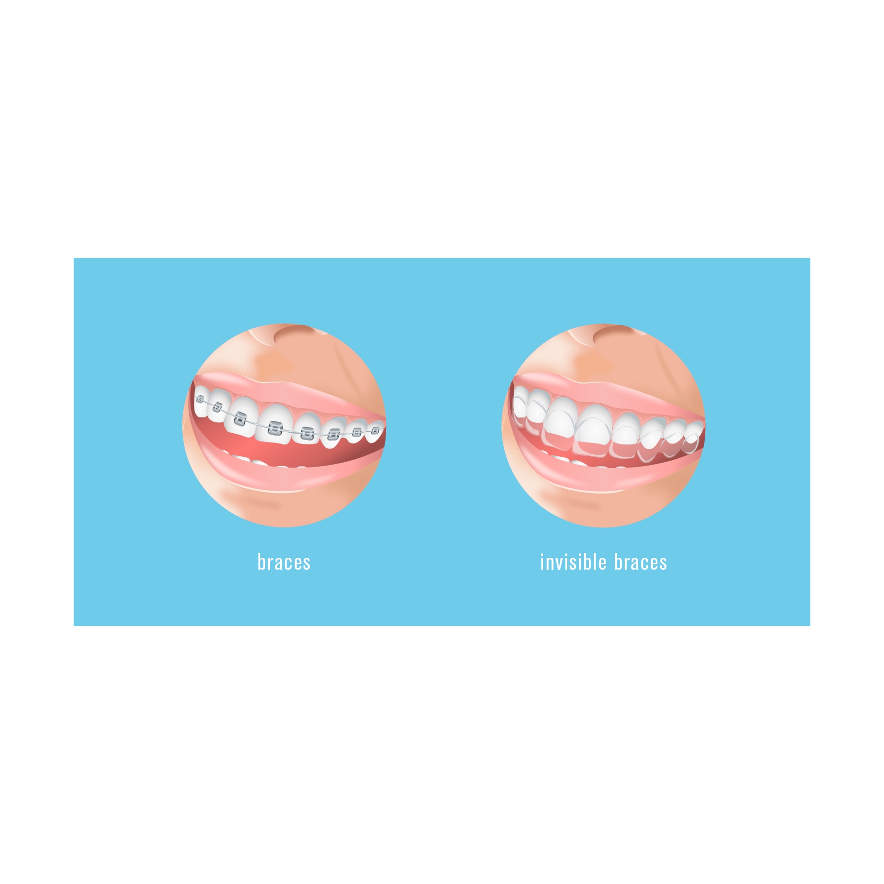 Illustration Design by Lezette_G for this project | Design #29900543