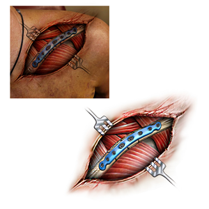 Tattoo Design by Georg15 for this project | Design #32340286