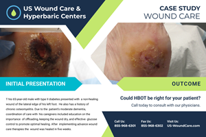 Flyer Design by Ascinate