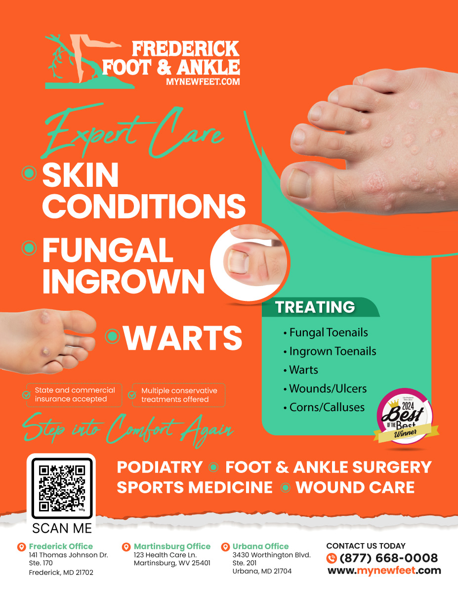 Flyer Design by Sergio Coelho for Frederick Foot & Ankle | Design #36103379
