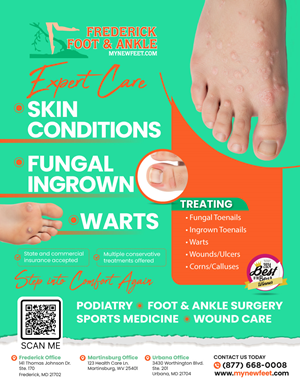 Flyer Design by Sergio Coelho for Frederick Foot & Ankle | Design: #36106403
