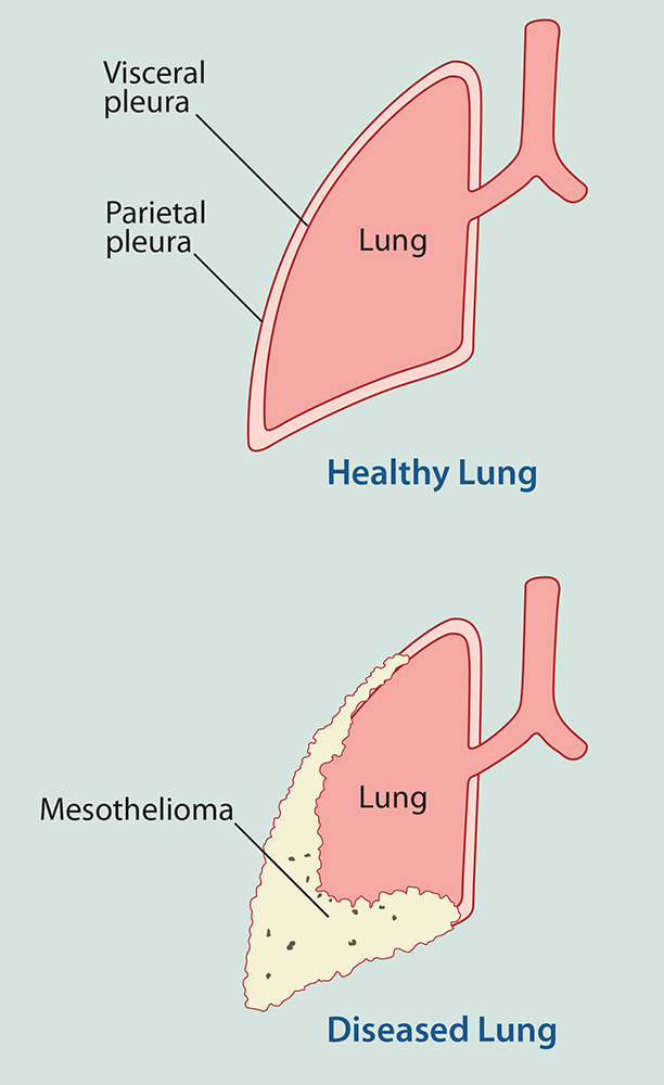Diseño Con Ilustración por rj holl Art Directions para Seeger Weiss LLP | Diseño #3682085