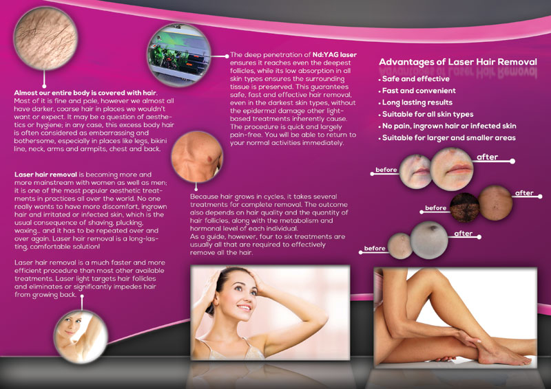 Brochure Design by alessandroevge for this project | Design #4290035