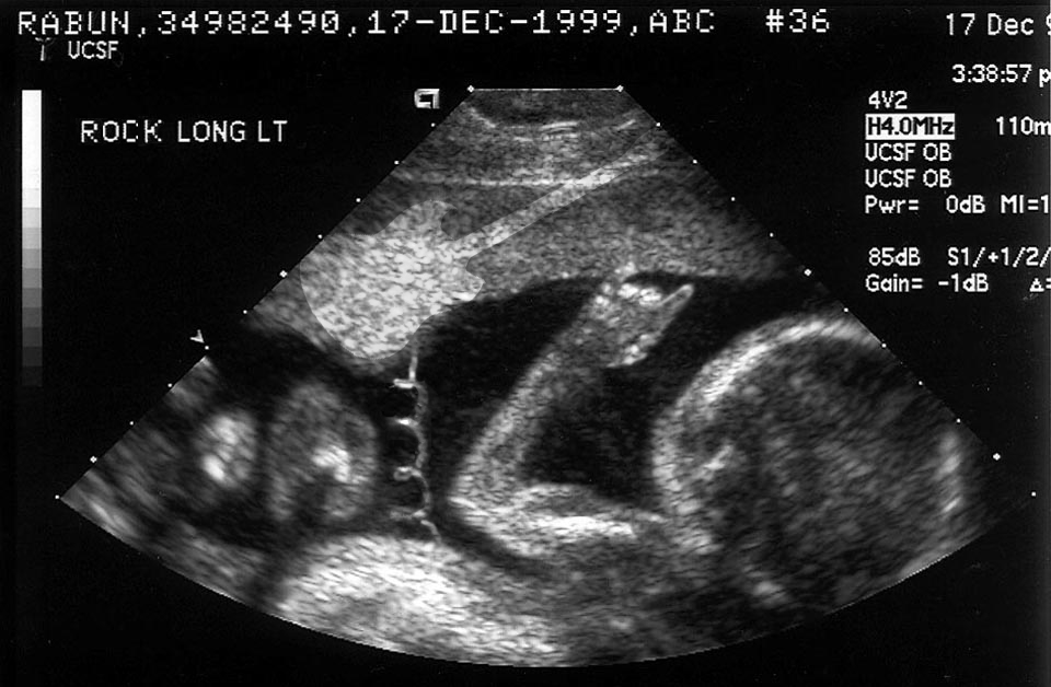 Photoshop-Design von chris_ für DesignCrowd (Community Contests) | Design #9138292