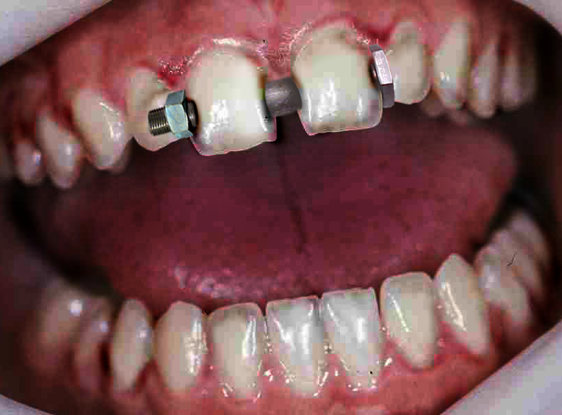 Diseño de Photoshop por Aaron para DesignCrowd (Community Contests) | Diseño #9085306