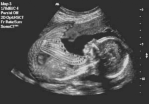 Photoshop Design by jondiddy for DesignCrowd (Community Contests) | Design #9095009