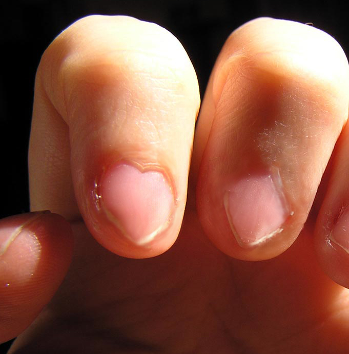 Photoshop Design by Pixelicious for DesignCrowd (Community Contests) | Design #9079179