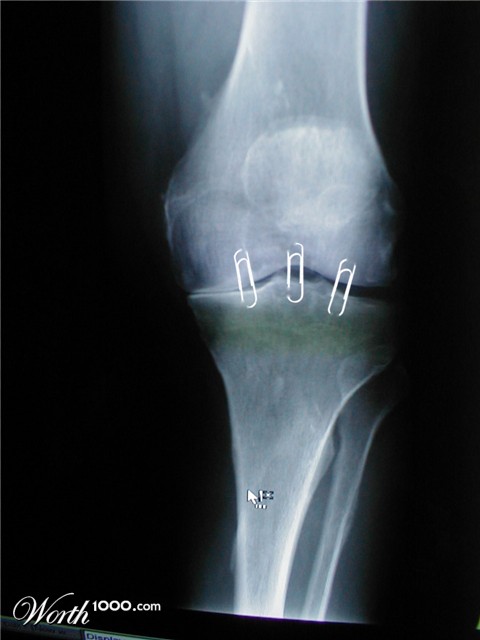 Photoshop Design by tonettonet