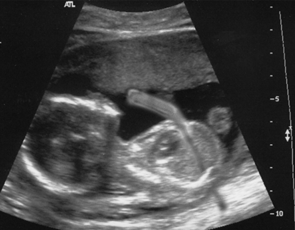 Photoshop Design by bcgirl007 for DesignCrowd (Community Contests) | Design #9077338