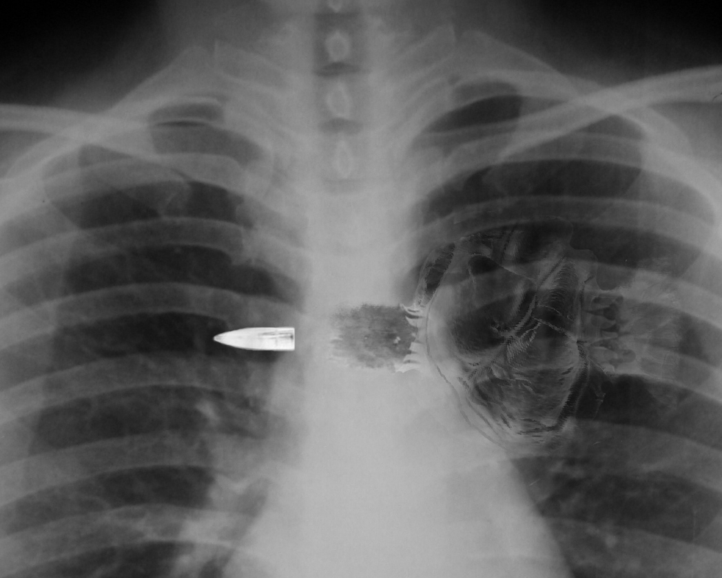 Photoshop Design by Ventrix for DesignCrowd (Community Contests) | Design #9063171