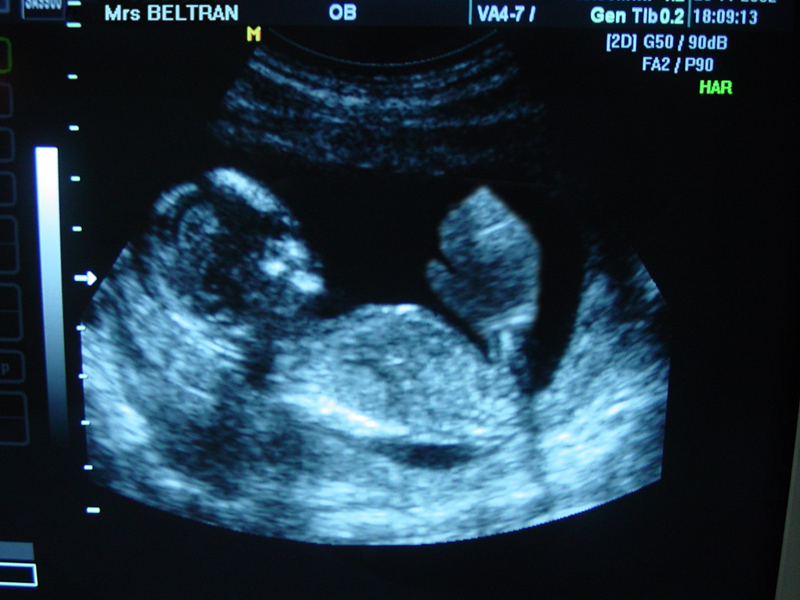 Photoshop Design by absalom996 for DesignCrowd (Community Contests) | Design #9058528