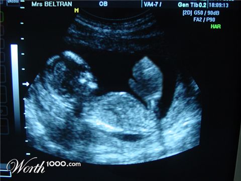 Photoshop Design by absalom996