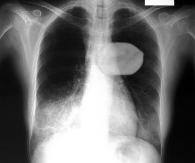 Photoshop Design by Irrwitzer for DesignCrowd (Community Contests) | Design #9057292