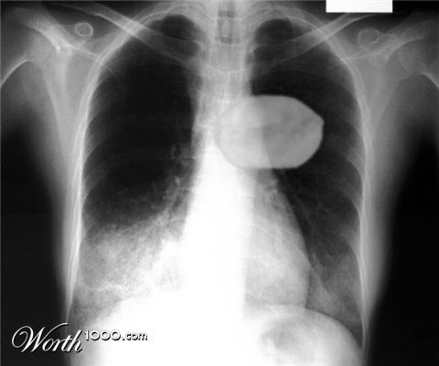 Photoshop Design by Irrwitzer