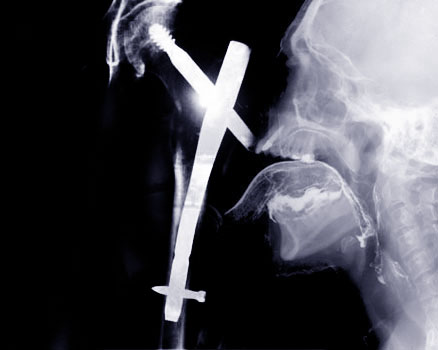 Photoshop Design by Downie for DesignCrowd (Community Contests) | Design #9051055