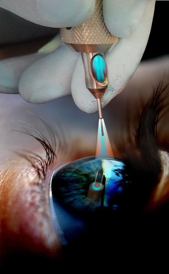 Photoshop Design by HDoyer for DesignCrowd (Community Contests) | Design #9023226