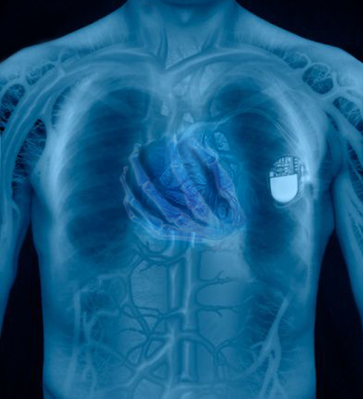 Diseño de Photoshop por sonjalina para DesignCrowd (Community Contests) | Diseño #9010368