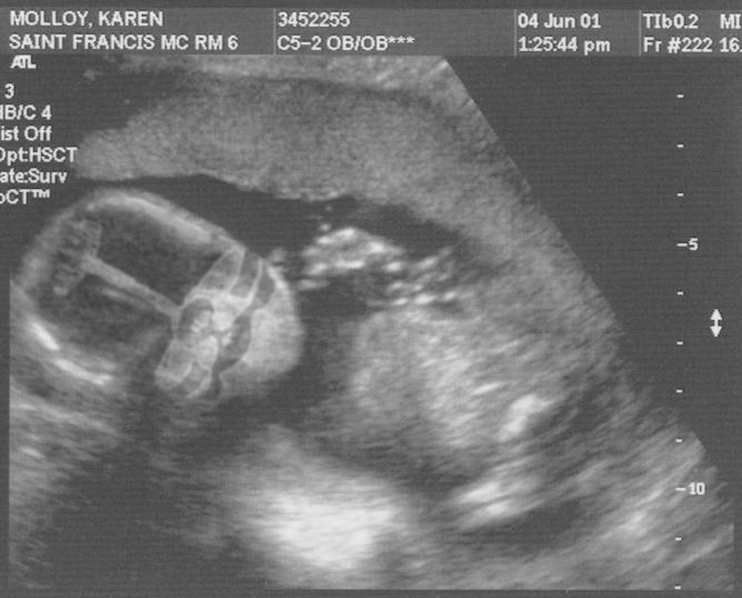 Photoshop Design by sophocha for DesignCrowd (Community Contests) | Design #9161679