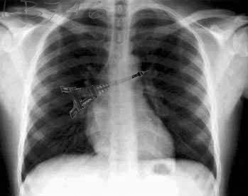 Design Photoshop par lostboy pour DesignCrowd (Community Contests) | Design #9162005