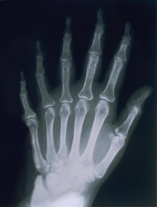 Photoshop Design by Flail for DesignCrowd (Community Contests) | Design #9159878