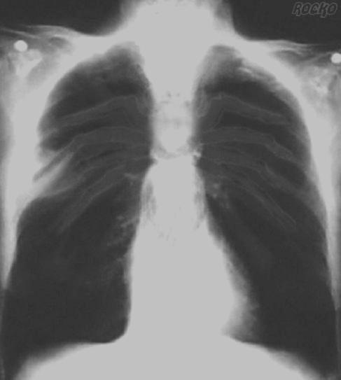 Photoshop-Design von Rocko für DesignCrowd (Community Contests) | Design #9159836