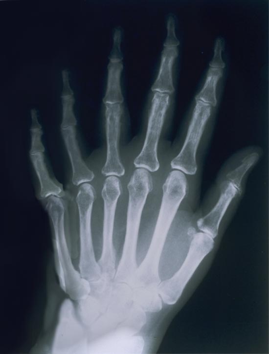 Photoshop Design by Flail for DesignCrowd (Community Contests) | Design #9158881