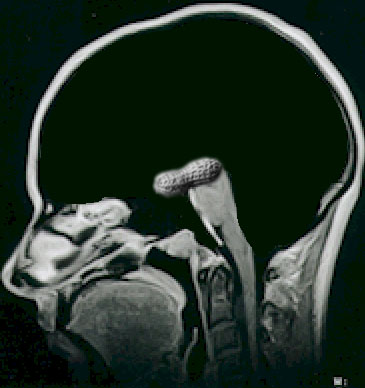 Photoshop-Design von Zutroy für DesignCrowd (Community Contests) | Design #9153077