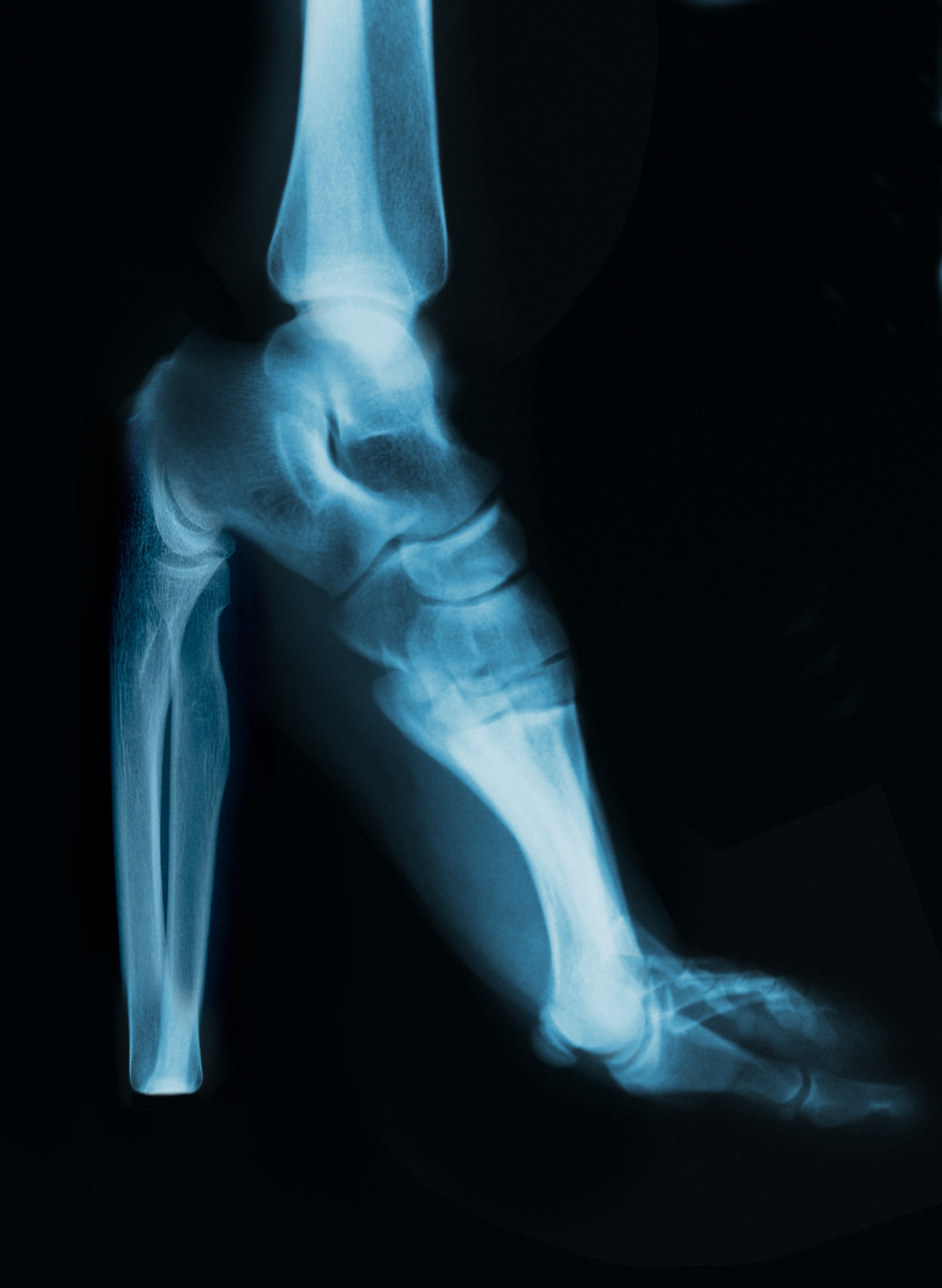 Photoshop Design by hl_maddy for DesignCrowd (Community Contests) | Design #9150773