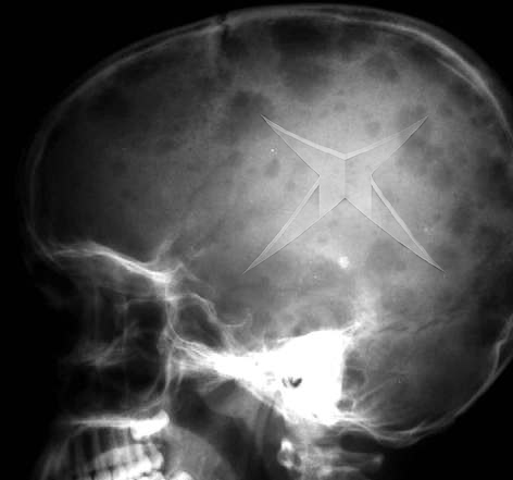 Photoshop-Design von Ranger_Rick für DesignCrowd (Community Contests) | Design #9150755