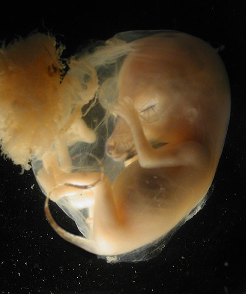 Photoshop Design by Puffnasty for DesignCrowd (Community Contests) | Design #9150804