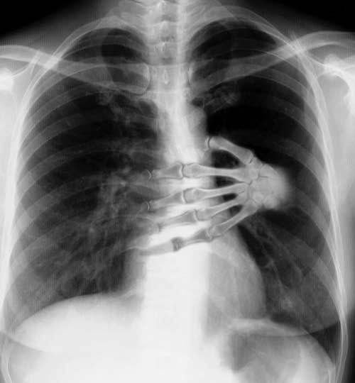 Photoshop Design by gunmetal for DesignCrowd (Community Contests) | Design #9151527