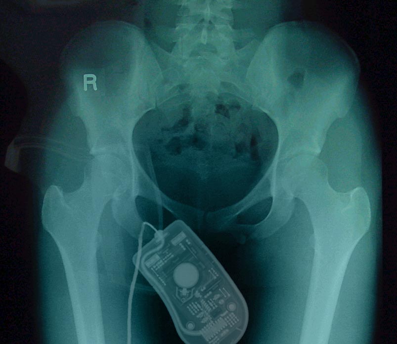 Photoshop Design by Axiom for DesignCrowd (Community Contests) | Design #9151531