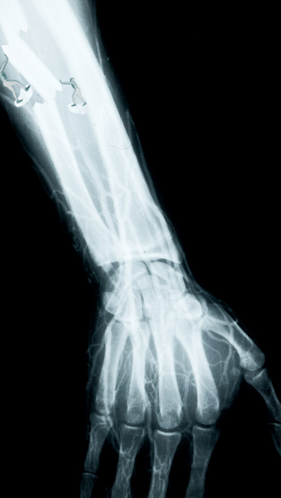 Photoshop Design by Wahoo for DesignCrowd (Community Contests) | Design #9145391