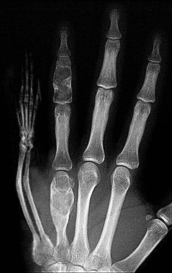 Photoshop Design by Tommy1de for DesignCrowd (Community Contests) | Design #9140448