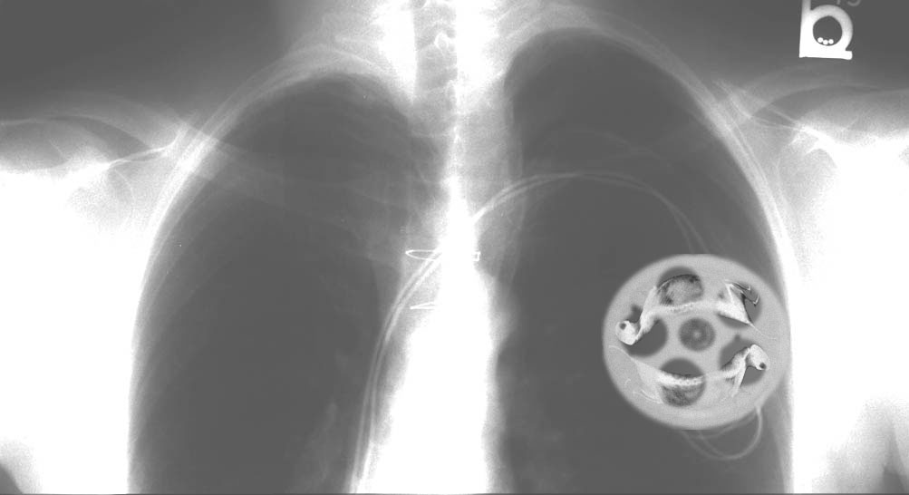 Photoshop Design by RealMeert for DesignCrowd (Community Contests) | Design #9140464