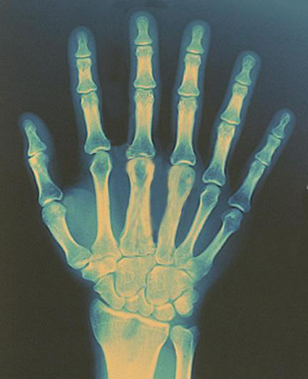 Photoshop Design by JoeyAce for DesignCrowd (Community Contests) | Design #9140500